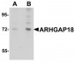 ARHGAP18 Antibody (C-Terminus)